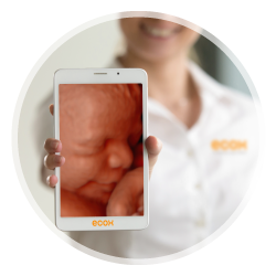 ecografias bebe 4d y 5d