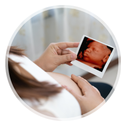 ecografias bebe 4d y 5d